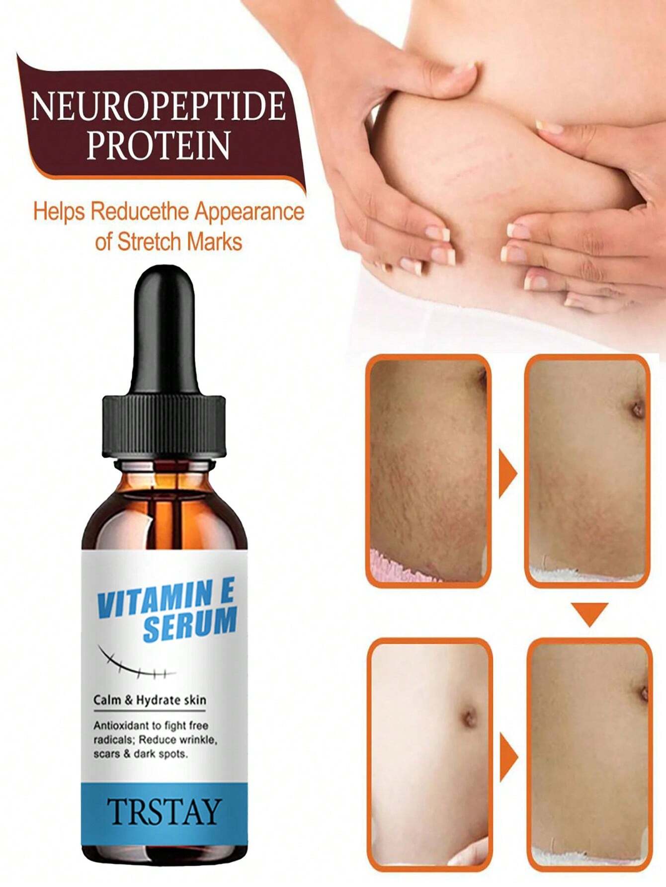 Esencia para eliminar estrías, esencia corporal de nutrición profunda para reparar cicatrices - Imagen 4