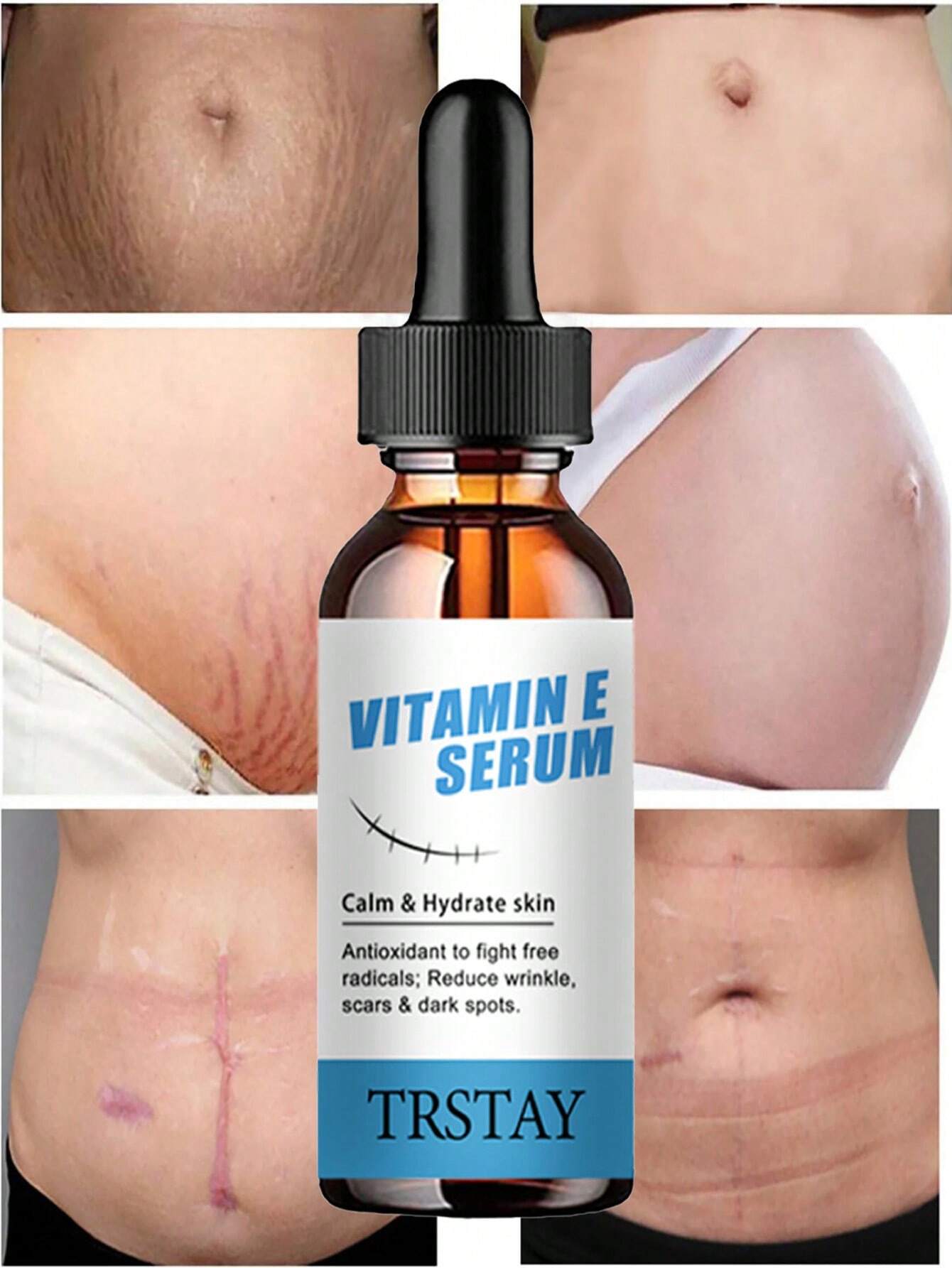 Esencia para eliminar estrías, esencia corporal de nutrición profunda para reparar cicatrices - Imagen 3